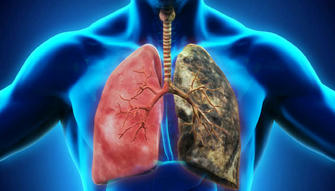 The Dangers of Second-Hand Smoke May Be Worse Than You Think
